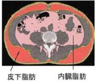 内臓脂肪断面図